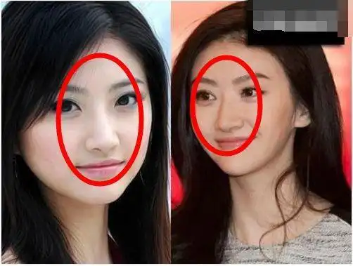 大唐荣耀景甜欧式大双眼皮闪耀景甜整容了吗