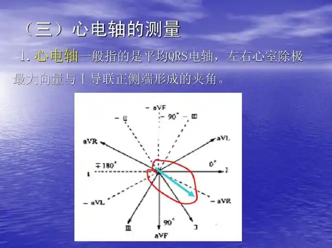 心电轴一般指的是平均qrs电轴,左右心室除极 最大向量与Ⅰ导联正侧端