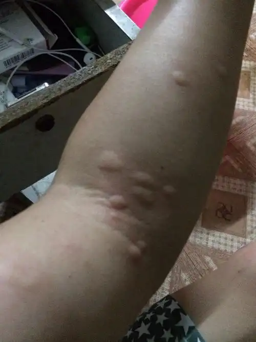 是不是飞蛾引起屋里好所飞蛾之类的小虫gaod