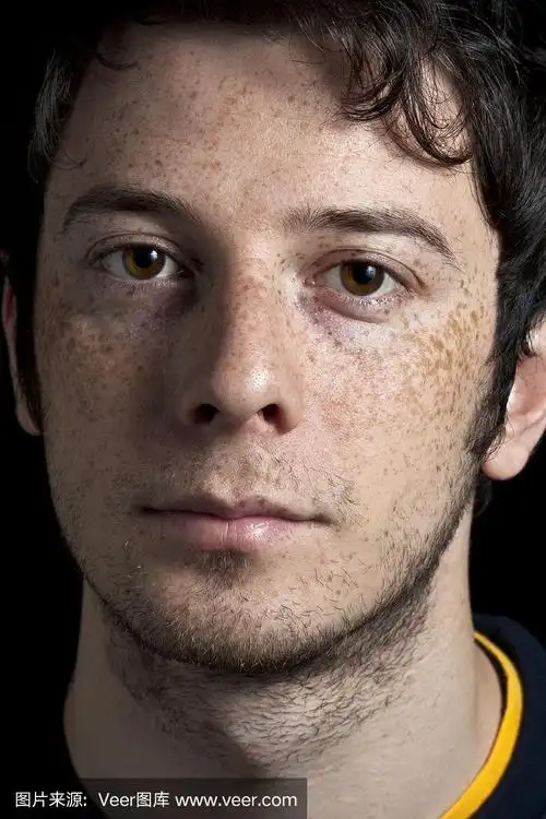 男孩与雀斑近距离