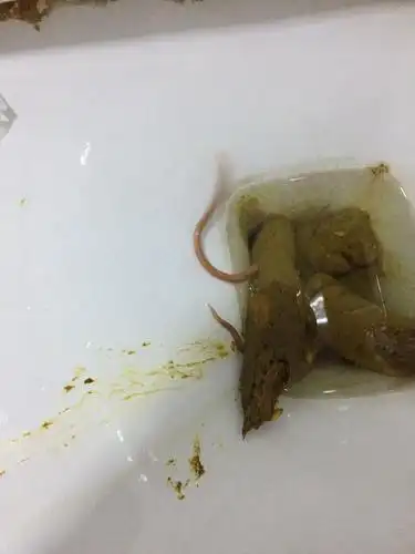 作为一个中年妇女居然拉出来一条粉红色虫子