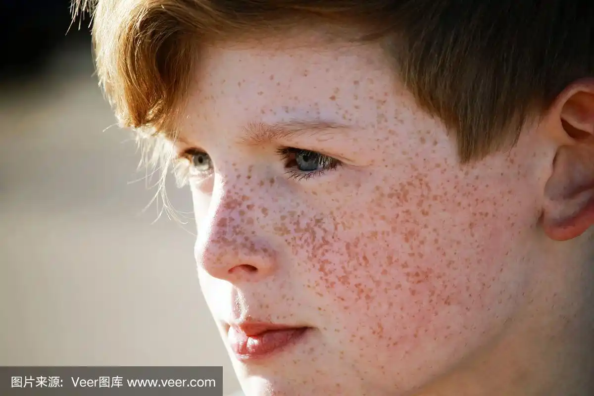 有雀斑的男孩