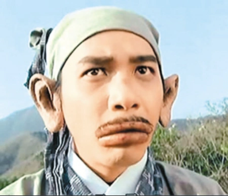 男子一发病就变成欧阳锋嘴肿得像香肠眼睛肿得像气球