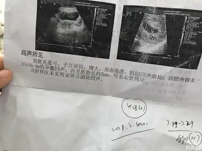 春暖花开!孕囊大小对照表"春意盎然"-第2张图片-西安论坛资讯