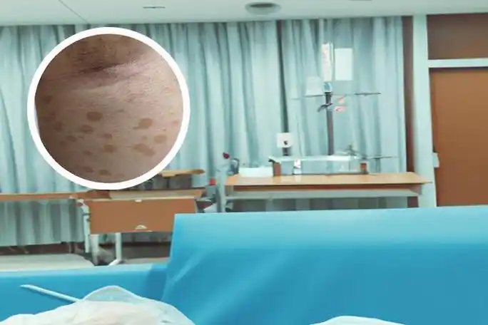 脖子有汗斑痒痒怎么办-久久皮肤病