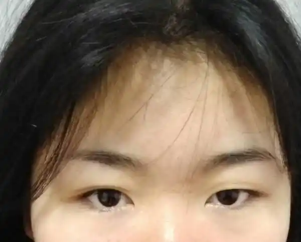 这个女孩是什么眼型啊,求解!