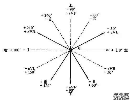 按照我们所讲应该属于电轴不偏,正常范围应该包括一部分电轴轻,中度左