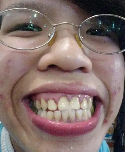 丑到你想吐!网络丑女排行榜top20