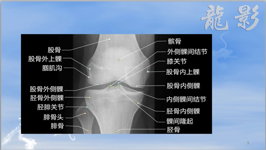 龙影影像公开课——胫骨结节骨软骨炎