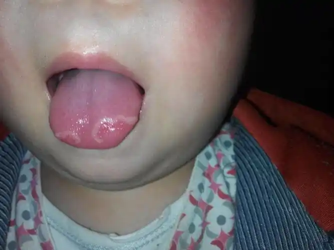 怎么会这样子呀_百度宝宝知道