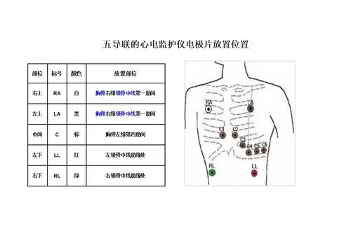 心电监护电极片位置