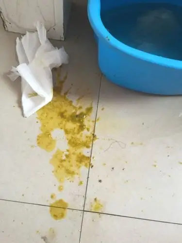 就拉肚子,吃了好几天药,好转了 但现在有时候就