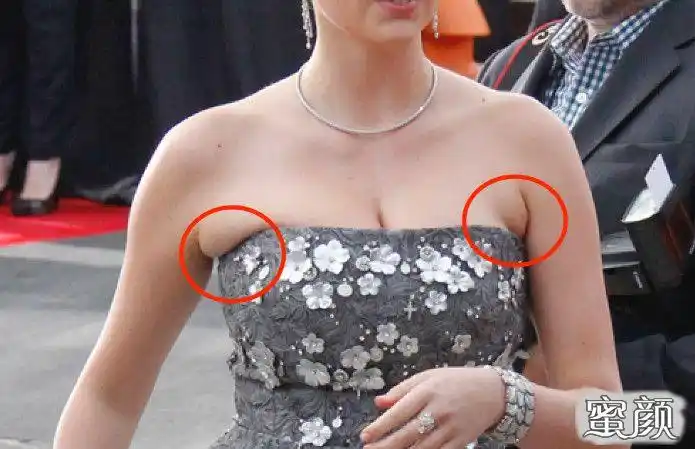 【美然】副乳,怎么才能让它顺利"下岗"?