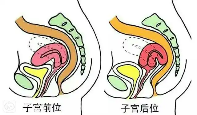 子宫前位或者后位,也能影响受孕吗
