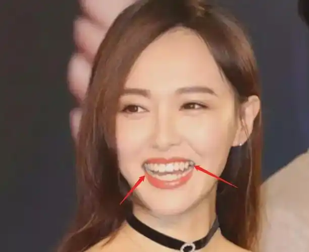 先来看看十分尴尬的色差问题吧,整了大牙的唐嫣,因为牙齿色差的缘故