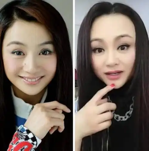 44岁曹颖脸部松弛疑似整容,网友:还以为是谢大脚