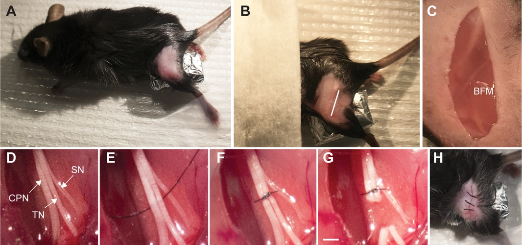 sparednerveinjurymodelofneuropathicpaininmice