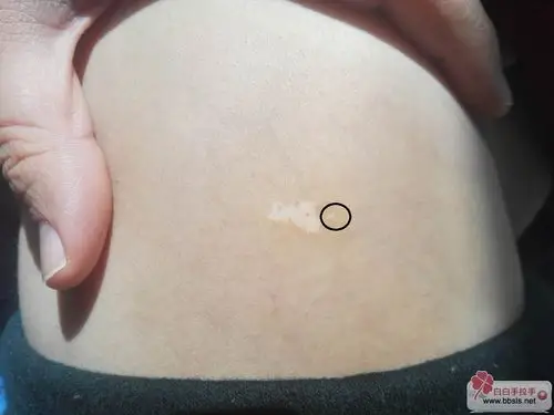 想问一个问题,这个白色小疙瘩是什么?