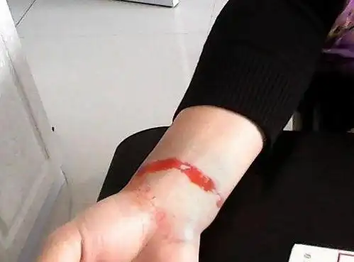 割手腕图片 - 搜狗图片搜索