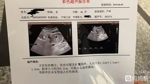 带着这个疑问跟着我一起来看看问题的正确答案吧怀孕7周孕囊胚芽大小