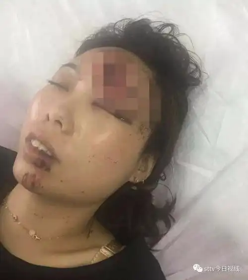 汕头澄海区一女子离婚翌日遭车祸,女子寻找肇事者