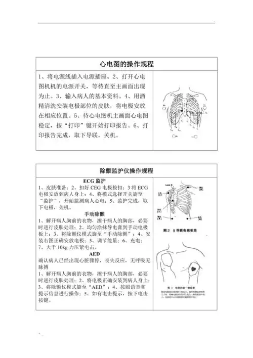 心电图的操作规程