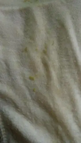 过后之后就成颗粒状的.有图:嫌恶心的就别进来