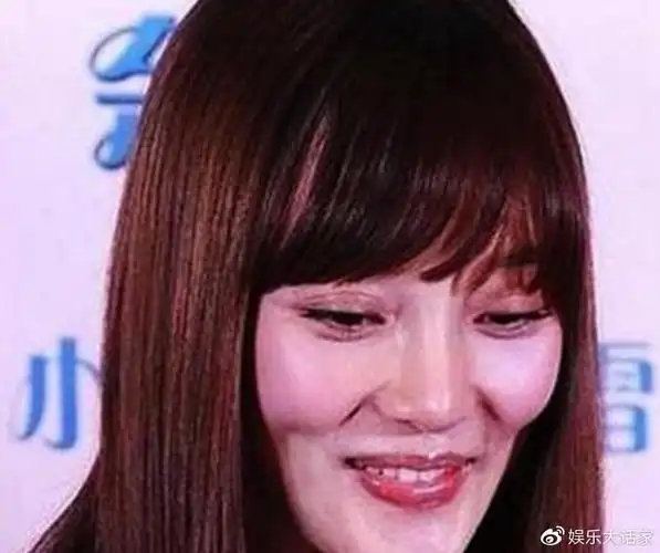 整容失败的六位女星第一个整成反面教材张檬真的太可惜了