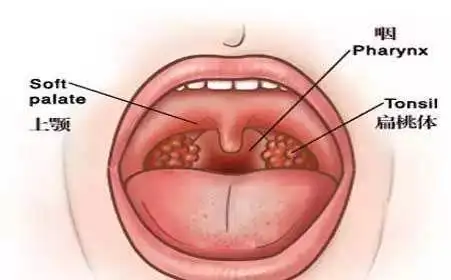 孩子睡觉打呼噜张嘴呼吸除了丑还要警惕腺样体肥大