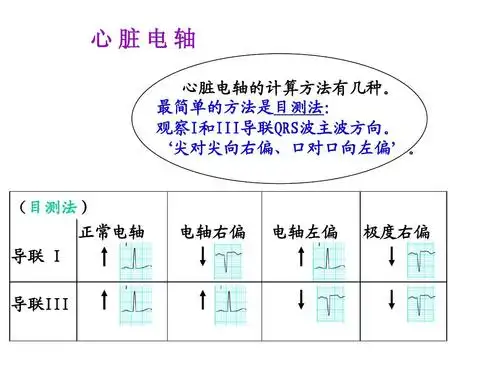 临床心电图教学ppt