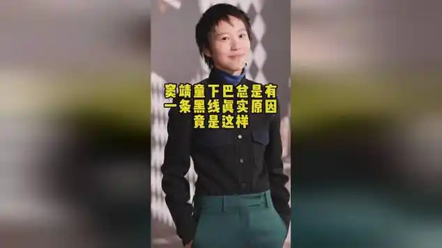 窦靖童下巴总是有一条黑线真实原因竟是这样|填词|古典音乐_网易视频