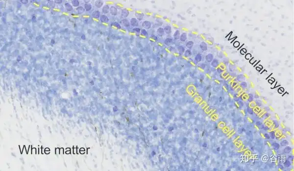 中间薄薄一层是单层浦肯野细胞层(purkinje cell layer),是硕大的浦肯