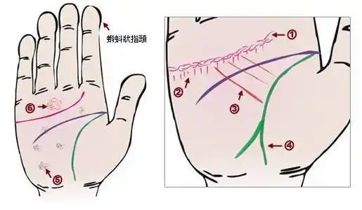 中医24种手诊图(值得参考)_生命线