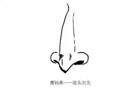有着鹰钩鼻,又叫结节鼻,是医学上的一种外鼻畸形,而在传统面相学中