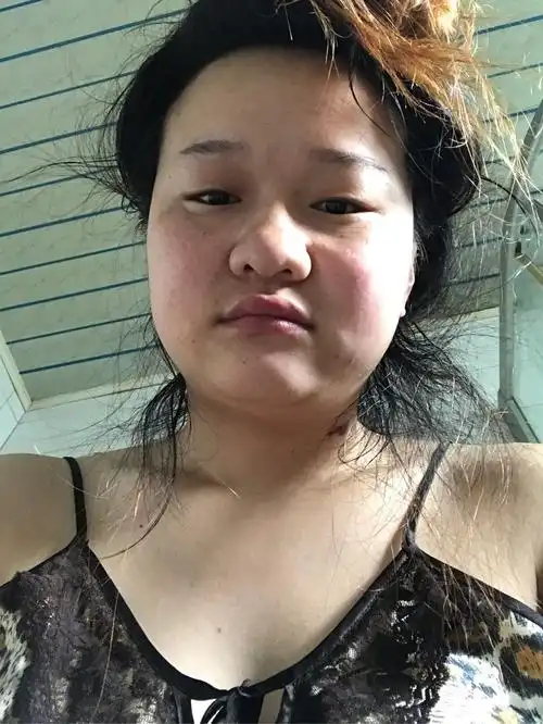 长得丑又喜欢自拍是什么心理