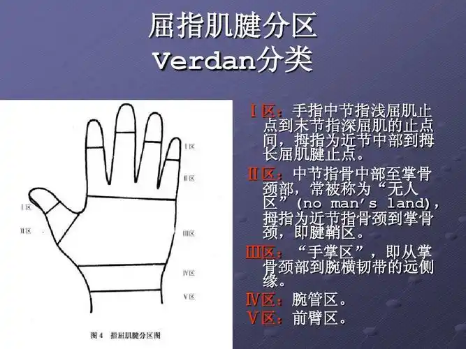无忧文档 所有分类 医药卫生 基础医学 肌腱缝合技术ppt 屈指肌腱分区