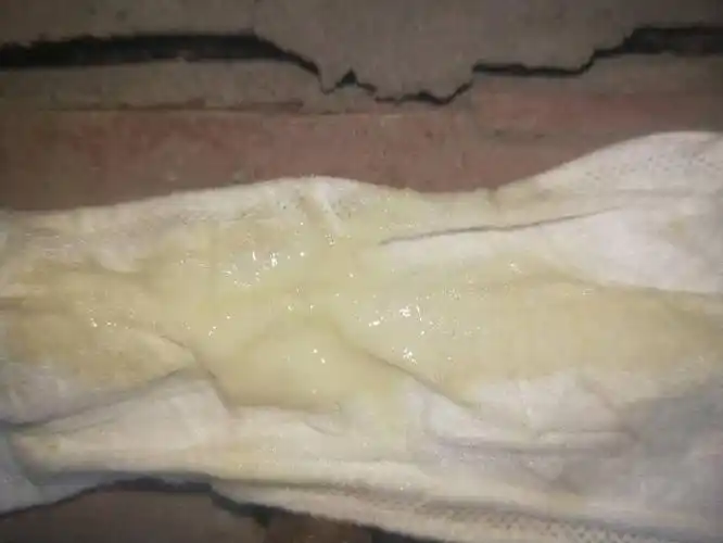 这样的的白带增多算不算异常?