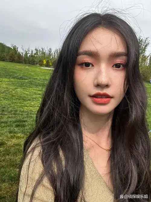 27岁林允公开医美过程,为去皱纹脸上扎满针眼,直呼医美需谨慎