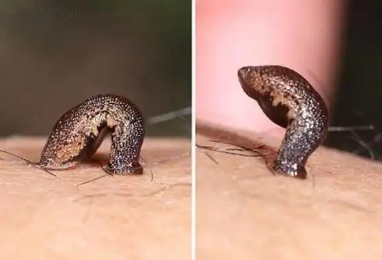 湘西苗族女人下蛊真实案件中蛊的人真无药可救吗