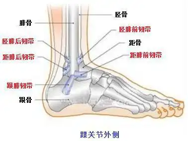 踝关节扭伤别大意,小心外侧副韧带损伤