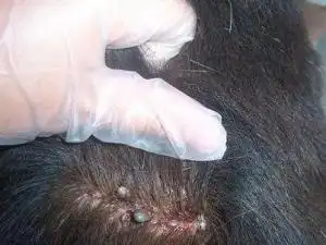 去虱子和虱子卵的有效方法