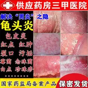 霉菌性龟头炎红点红肿瘙痒专用药膏治疗阴茎裂口用药包皮炎消炎膏