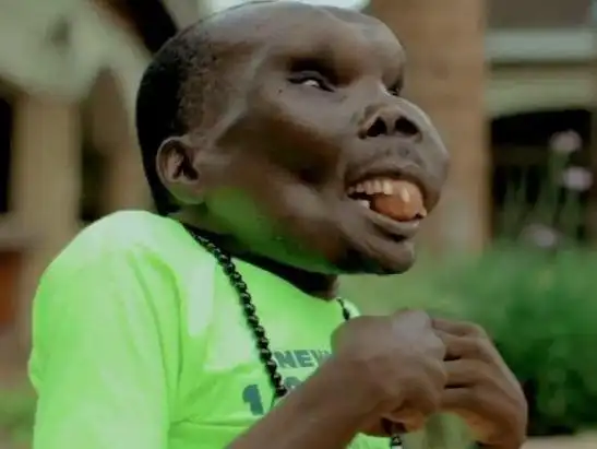 世界最丑男人拥有完美爱情和8个孩子,爱妻曾受迫离去终回心转意