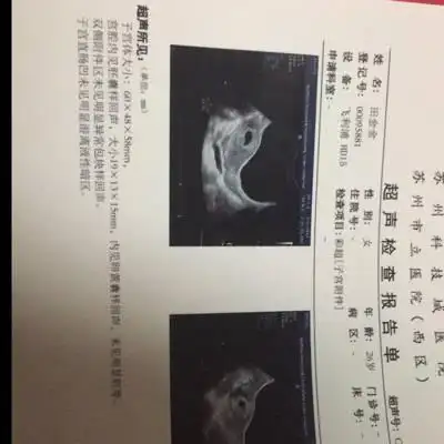 请问怀孕40天的bc单,孕囊19*13*15是男孩还是女孩?