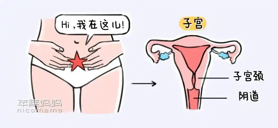 影响子宫健康的这个小东西90的妈妈都没重视