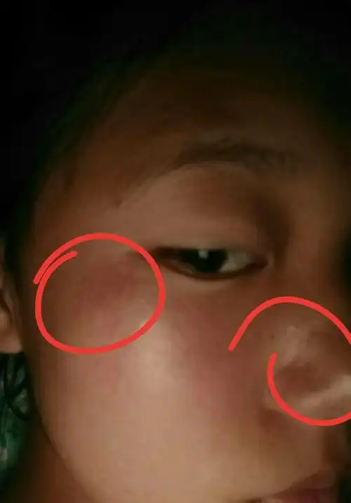 去军训时是晒爆皮还是晒出斑来了?求懂的回答,谢谢,很重要.