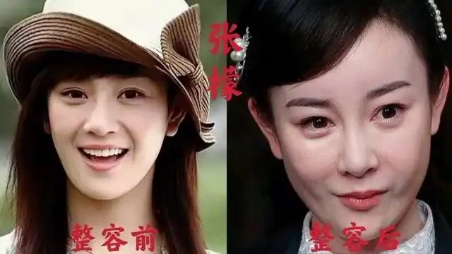 【张檬】6到32岁的变化,为爱整容,葬送了整个演艺生涯!