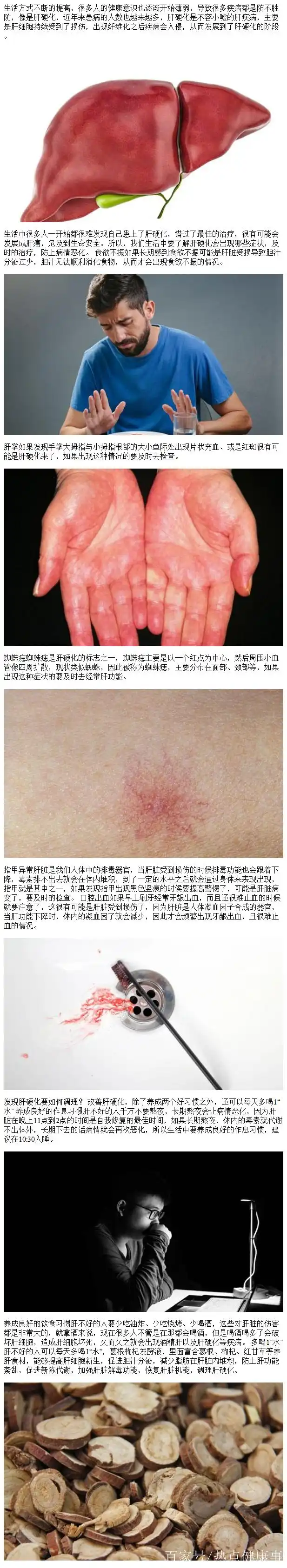 5个征兆早发现,或能逆转肝硬化