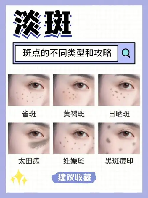 姐妹们斑点的不同类型和攻略我就放这了