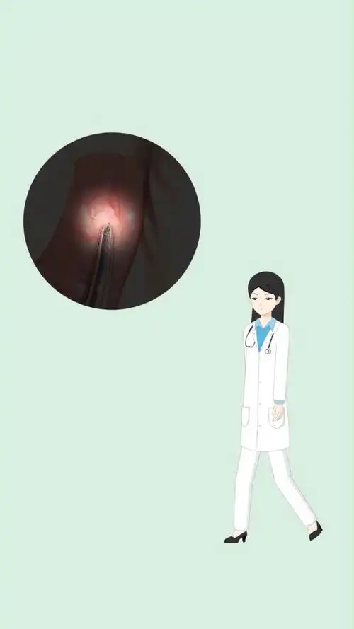 尿道口一圈锯齿状肉芽 尿道口锯齿状肉粒_百科-思特网